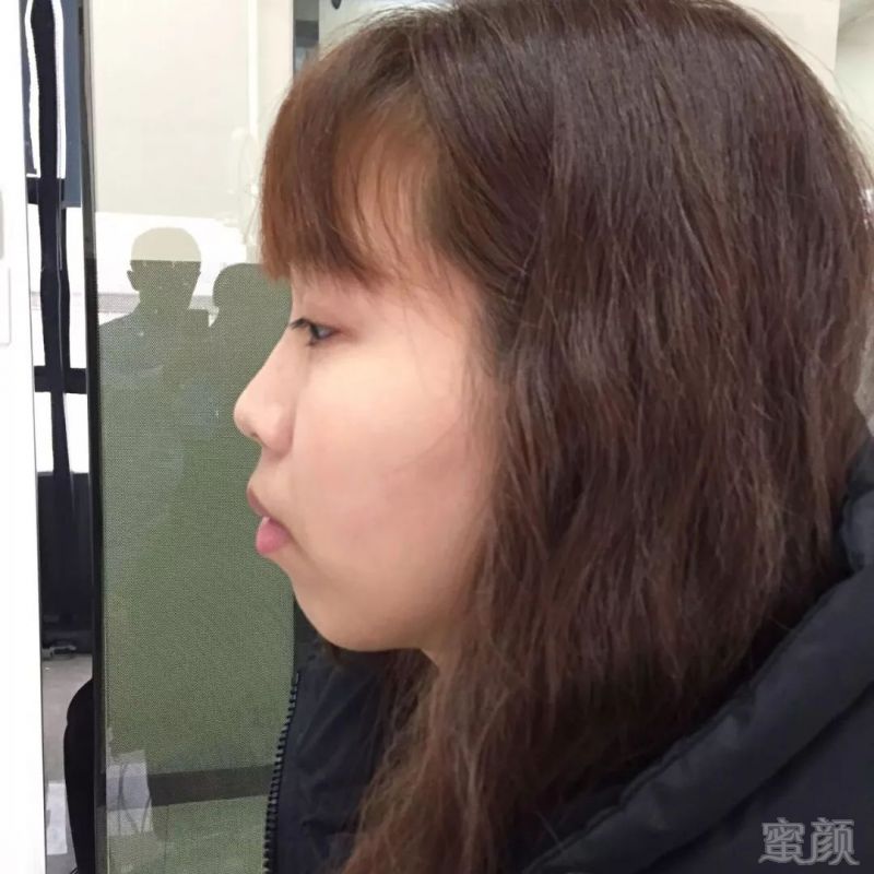 https://img.miyanlife.com/mnt/timg/180927/134252C11-12.jpg