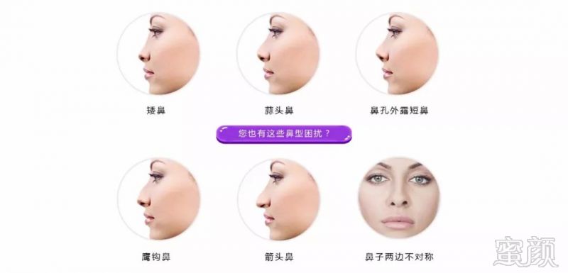https://img.miyanlife.com/mnt/timg/180927/134520H24-0.jpg