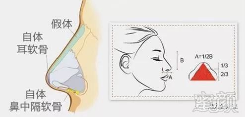https://img.miyanlife.com/mnt/timg/180927/13464a300-5.jpg