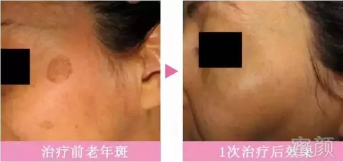 https://img.miyanlife.com/mnt/timg/180928/1232051253-3.jpg