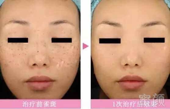 https://img.miyanlife.com/mnt/timg/180928/1232051525-2.jpg