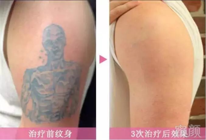 https://img.miyanlife.com/mnt/timg/180928/1232056003-4.jpg