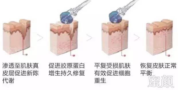https://img.miyanlife.com/mnt/timg/180928/12401B404-3.jpg