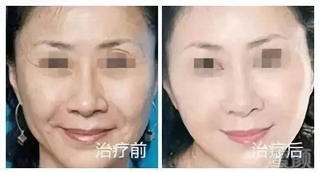 https://img.miyanlife.com/mnt/timg/180928/12401HL2-13.jpg