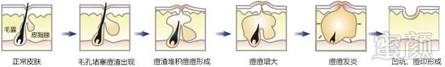 https://img.miyanlife.com/mnt/timg/180928/1240315V4-2.jpg