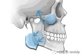 案例图片