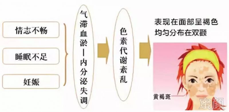 https://img.miyanlife.com/mnt/timg/180928/1250554F6-3.jpg