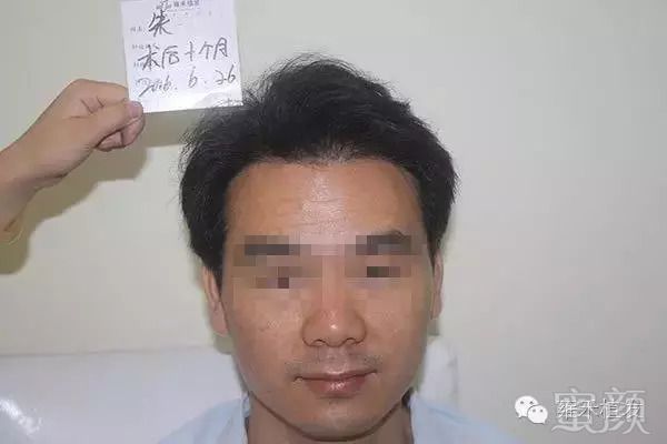 https://img.miyanlife.com/mnt/timg/180928/13031064K-14.jpg