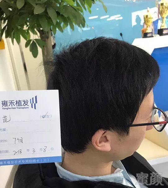 https://img.miyanlife.com/mnt/timg/180928/1351002312-9.jpg
