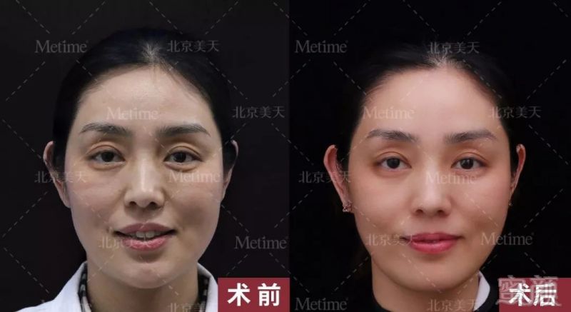 https://img.miyanlife.com/mnt/timg/180928/1351155015-2.jpg