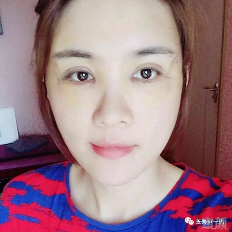 https://img.miyanlife.com/mnt/timg/180928/1351214C9-2.jpg