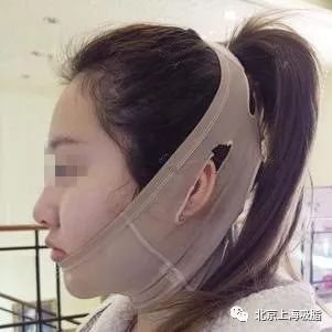 https://img.miyanlife.com/mnt/timg/180928/1356245638-2.jpg