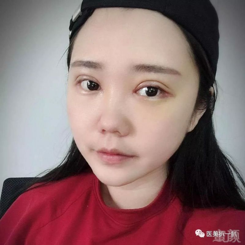 https://img.miyanlife.com/mnt/timg/180928/135A94433-2.jpg