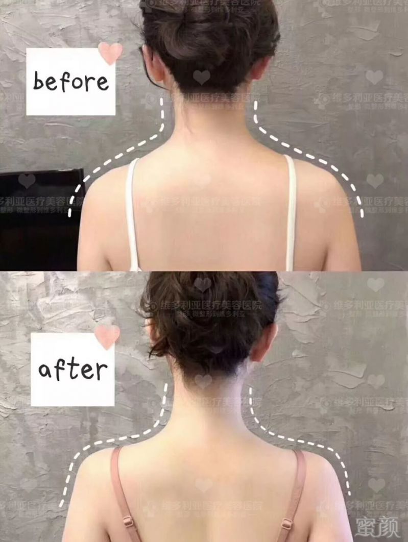 https://img.miyanlife.com/mnt/timg/180928/140611KZ-6.jpg