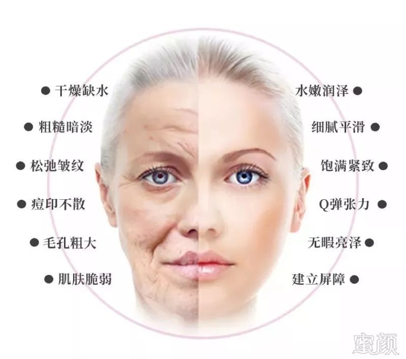 https://img.miyanlife.com/mnt/timg/180928/14092050b-1.jpg