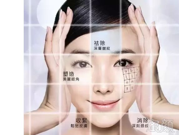 https://img.miyanlife.com/mnt/timg/180928/140Q54T3-3.jpg
