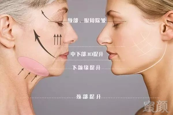 https://img.miyanlife.com/mnt/timg/180928/140Q56192-2.jpg