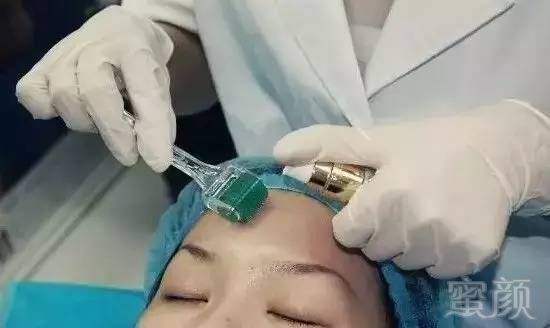 https://img.miyanlife.com/mnt/timg/180929/10415AT6-2.jpg