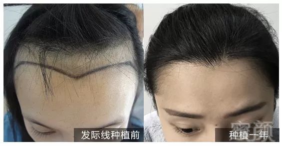 https://img.miyanlife.com/mnt/timg/180929/10434124Y-8.jpg