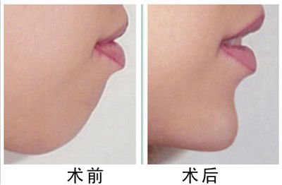 https://img.miyanlife.com/mnt/timg/180929/105915K49-4.jpg