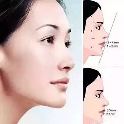 https://img.miyanlife.com/mnt/timg/180929/10592VK3-6.jpg