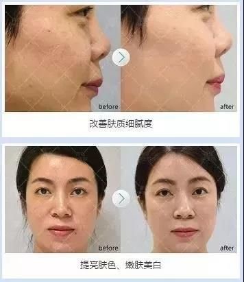 https://img.miyanlife.com/mnt/timg/180929/1115292E7-7.jpg