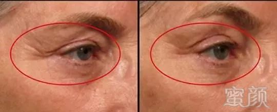 https://img.miyanlife.com/mnt/timg/180929/111529B46-9.jpg