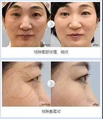 https://img.miyanlife.com/mnt/timg/180929/11152Q334-6.jpg