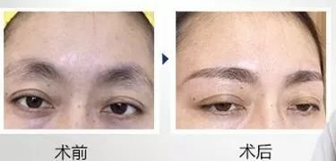 https://img.miyanlife.com/mnt/timg/180929/11152S610-2.jpg