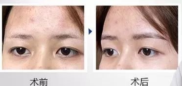 https://img.miyanlife.com/mnt/timg/180929/11152W224-1.jpg