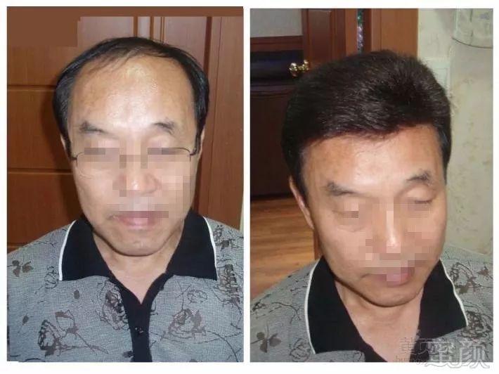 https://img.miyanlife.com/mnt/timg/180929/1135442B8-2.jpg