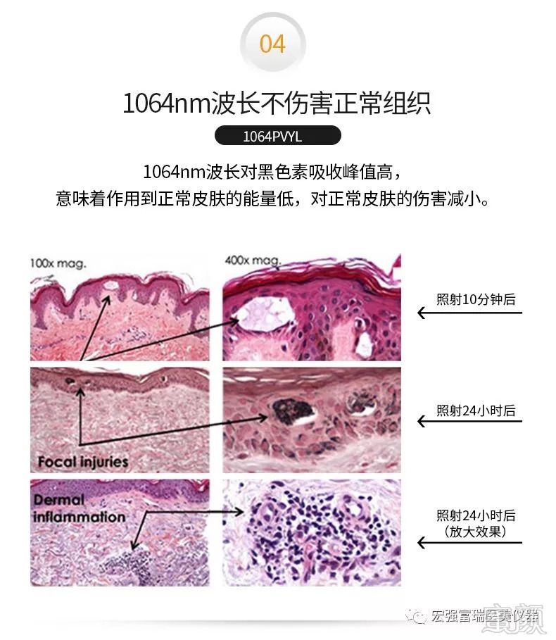 https://img.miyanlife.com/mnt/timg/180929/11395H026-4.jpg
