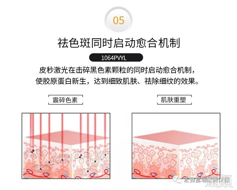 https://img.miyanlife.com/mnt/timg/180929/11395I5D-5.jpg