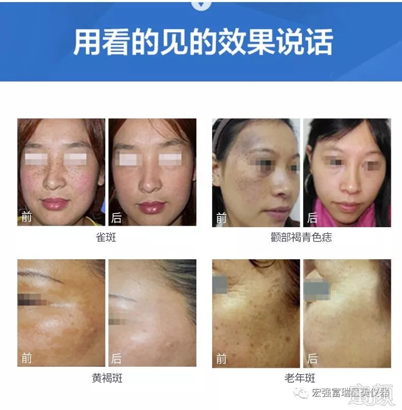 https://img.miyanlife.com/mnt/timg/180929/11395R5M-7.jpg