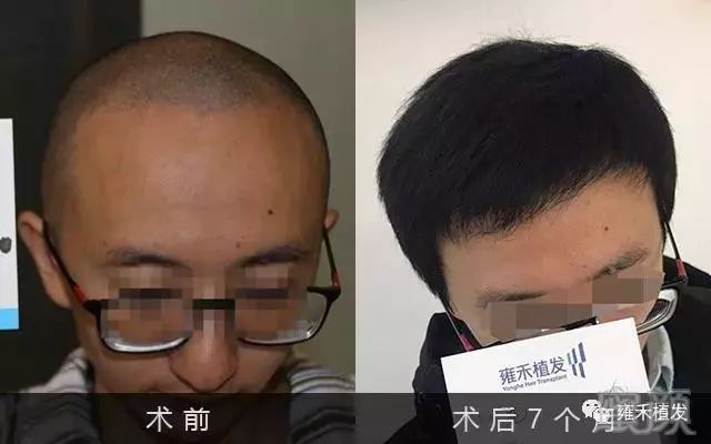 https://img.miyanlife.com/mnt/timg/180929/11400J638-5.jpg