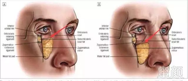 https://img.miyanlife.com/mnt/timg/180929/1143354Z1-9.jpg