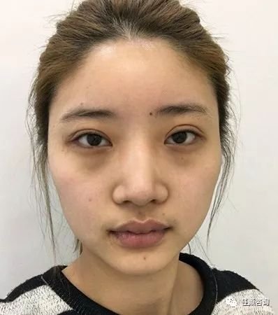 https://img.miyanlife.com/mnt/timg/180929/1156255920-0.jpg