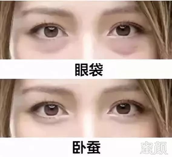 https://img.miyanlife.com/mnt/timg/180929/1202226222-4.jpg