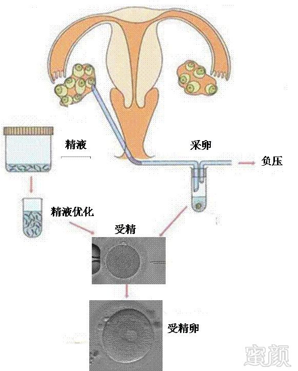https://img.miyanlife.com/mnt/timg/180929/12153A139-2.jpg
