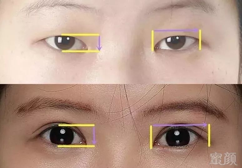 https://img.miyanlife.com/mnt/timg/180929/121Z13438-1.jpg