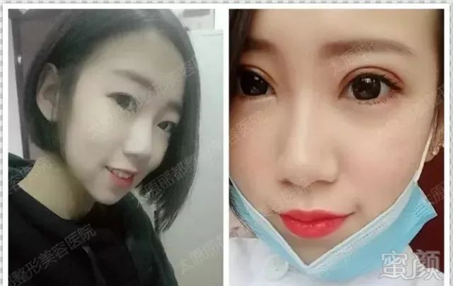 https://img.miyanlife.com/mnt/timg/180929/121Z34622-13.jpg