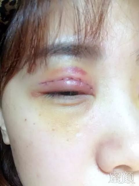 https://img.miyanlife.com/mnt/timg/180929/122U94M4-14.jpg