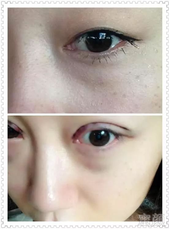 https://img.miyanlife.com/mnt/timg/180929/122UR1B-7.jpg
