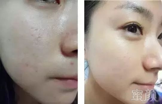 https://img.miyanlife.com/mnt/timg/180929/13020623K-7.jpg