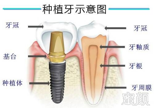 https://img.miyanlife.com/mnt/timg/180929/1302254T5-0.jpg