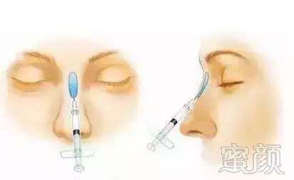 https://img.miyanlife.com/mnt/timg/180929/13033VN6-10.jpg