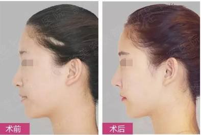 https://img.miyanlife.com/mnt/timg/180929/13033W228-2.jpg