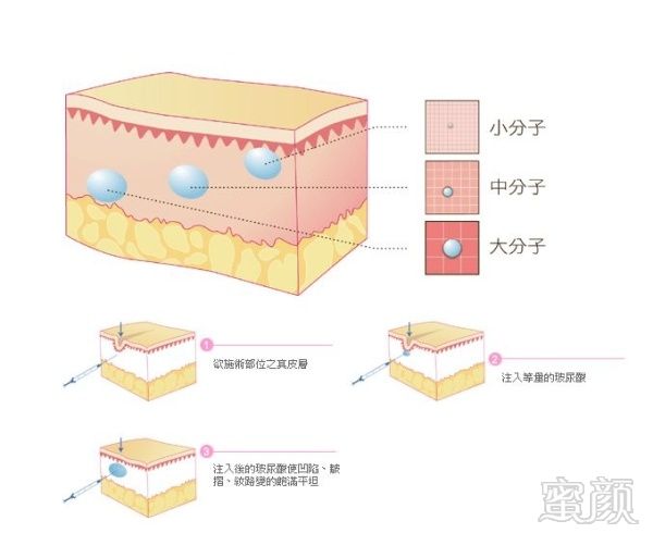 案例图片