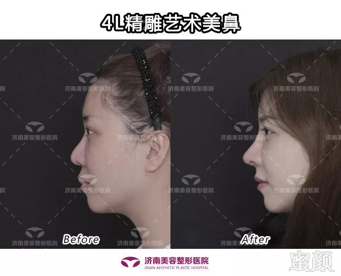 https://img.miyanlife.com/mnt/timg/180930/105G51326-9.jpg