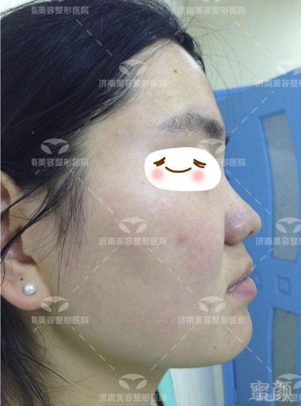 https://img.miyanlife.com/mnt/timg/180930/105G54454-6.jpg